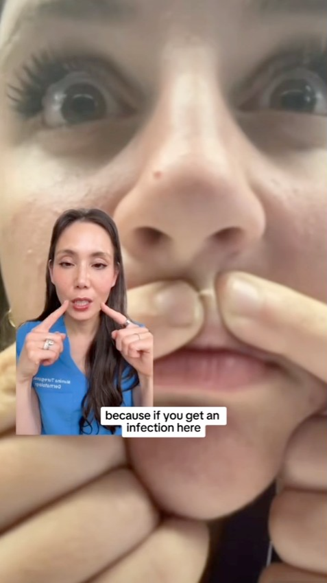 A woman touching her face, apparently to pop a pimple